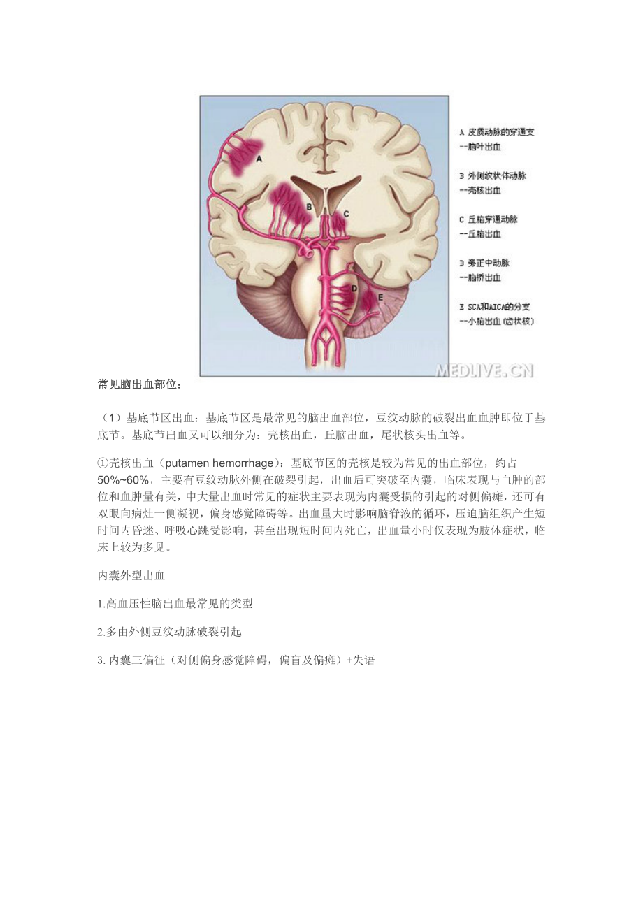 脑出血部位辨识汇总.doc_第3页