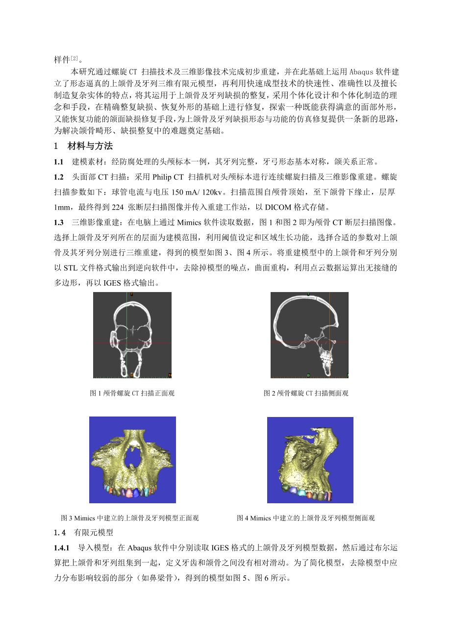 毕业论文（设计）基于CT 扫描和激光烧结技术的上颌骨及牙列三维仿真与修复07649.doc_第2页