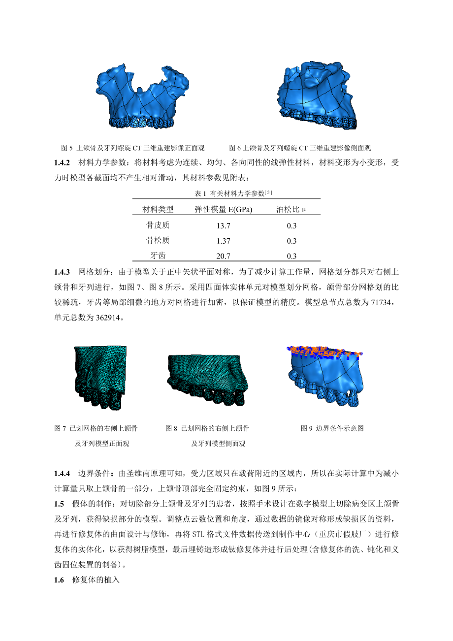 毕业论文（设计）基于CT 扫描和激光烧结技术的上颌骨及牙列三维仿真与修复07649.doc_第3页