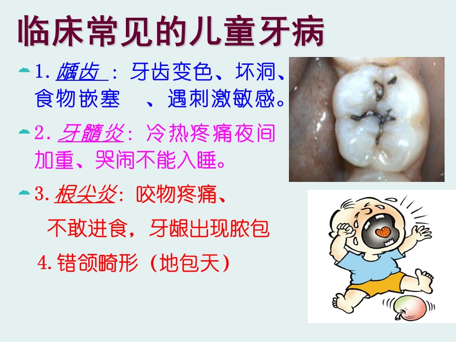 儿童牙病的预防.ppt精编版课件.ppt_第2页