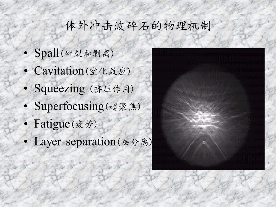 体外冲击波碎石的物理机制及生物效应-课件.ppt_第3页