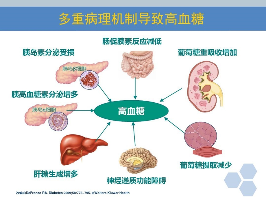 口服降糖药护理ppt精要课件.ppt_第2页