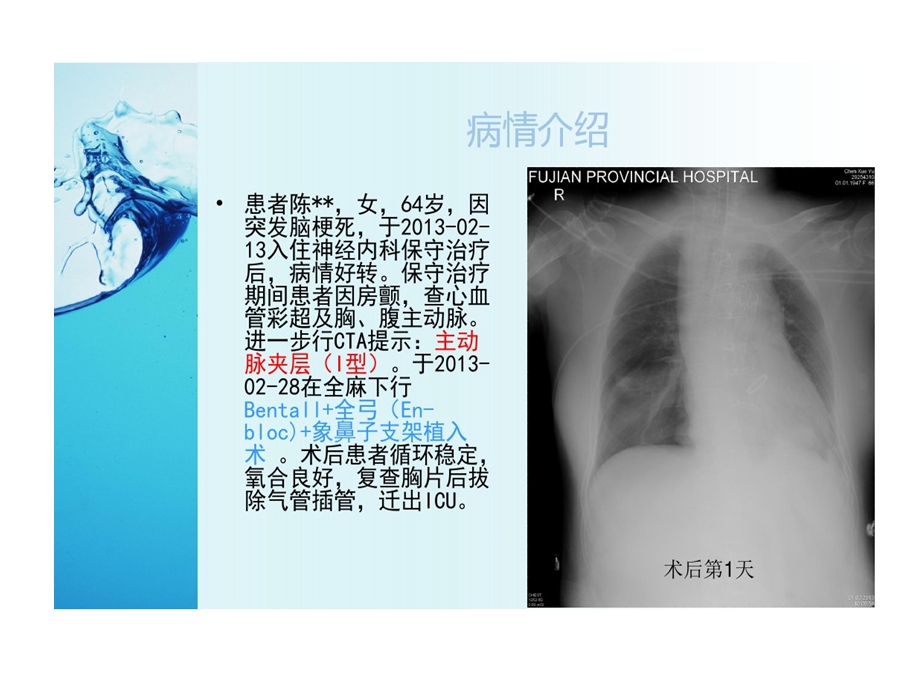 困难脱机成功的案例课件.ppt_第2页