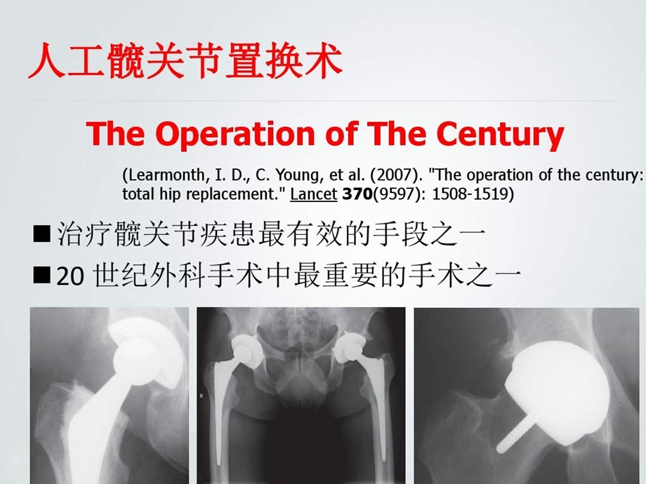 人工髋关节假体设计的材料学考量PPT文档课件.ppt_第3页