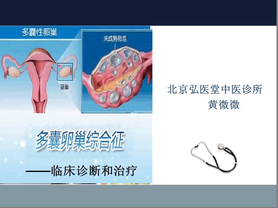 多囊卵巢综合征ppt课件.ppt_第1页