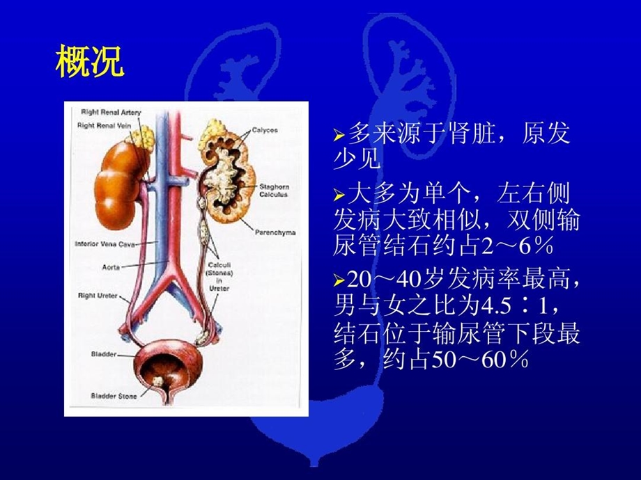 多层螺旋CT在输尿管结石诊断中的应用课件.ppt_第2页