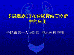 多层螺旋CT在输尿管结石诊断中的应用课件.ppt