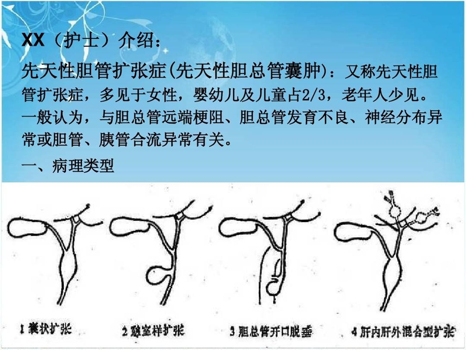 先天性胆总管囊肿护理查房课件.ppt_第3页