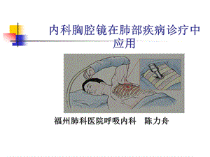 内科胸腔镜-课件.ppt