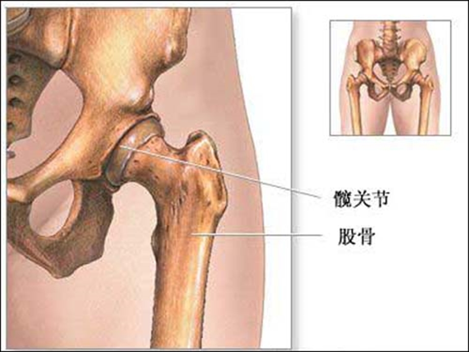 人工全髋关节置换术后功能锻炼课件.ppt_第2页