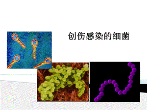 创伤感染的细菌课件.ppt