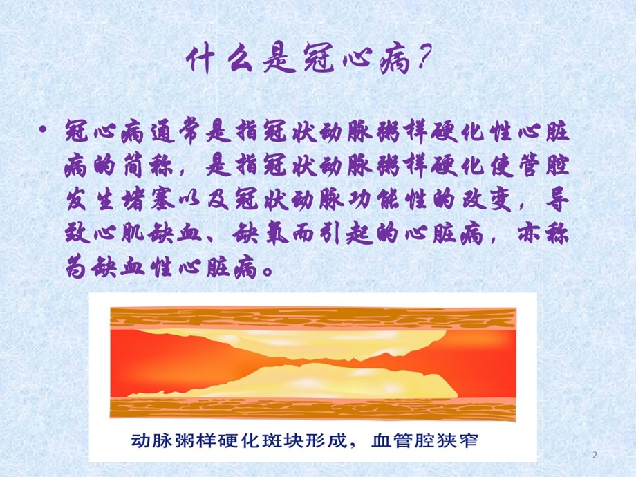 小讲课冠心病课件.ppt_第2页