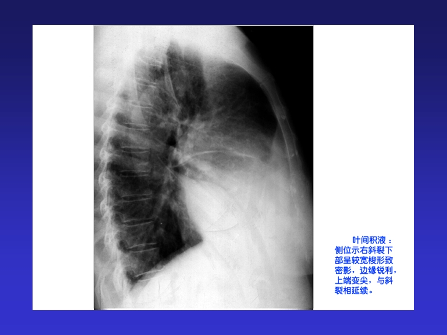 呼吸系统及纵隔多媒体教材课件.ppt_第1页