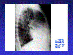 呼吸系统及纵隔多媒体教材课件.ppt