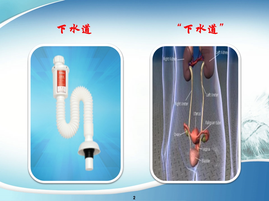 《双j管22》课件.ppt_第2页