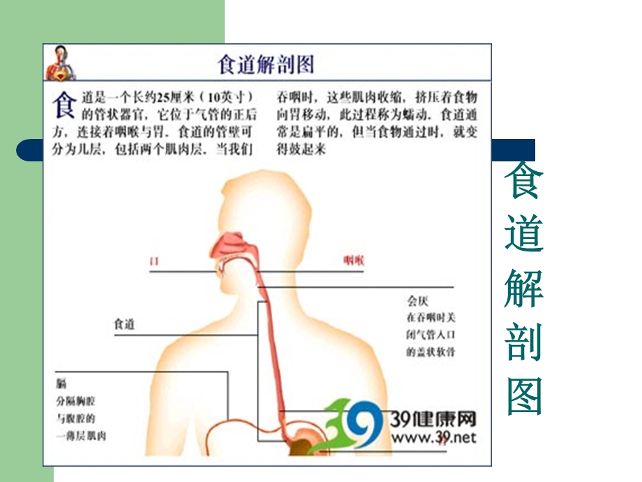 食管癌的介入治疗课件.ppt_第3页