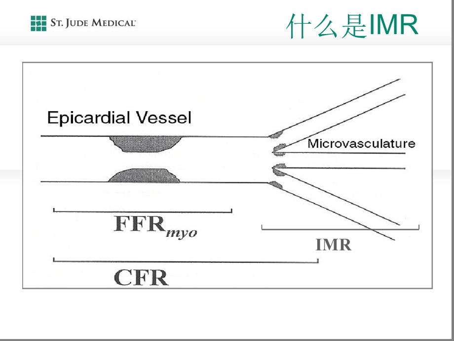 IMR概念和测量1解读课件.ppt_第2页