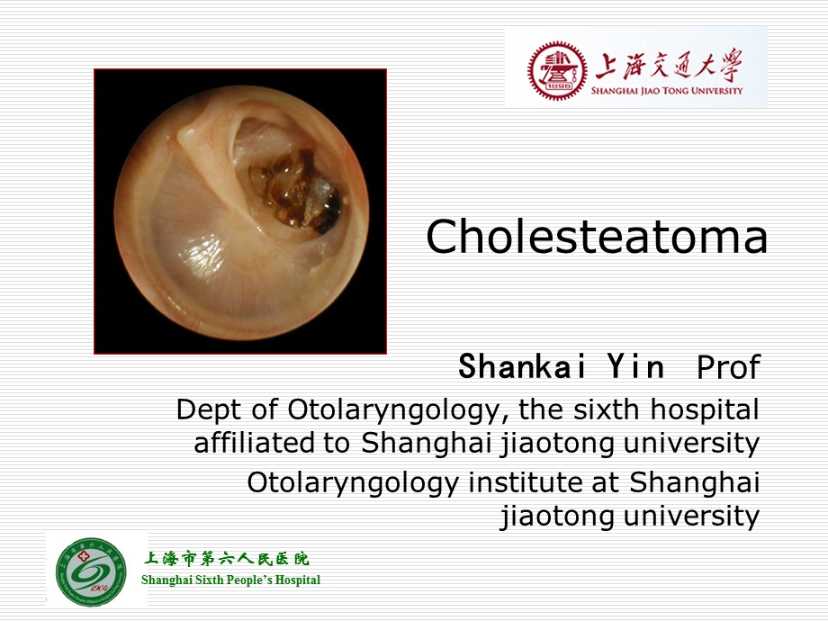 耳鼻咽喉科学英文版ppt课件 cholesteatoma.ppt_第1页