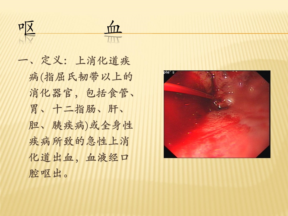 呕血与便血教学ppt课件.ppt_第3页