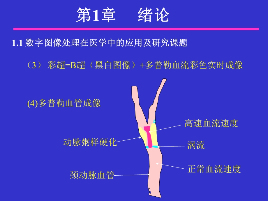 医学图像处理--绪论课件.ppt_第3页