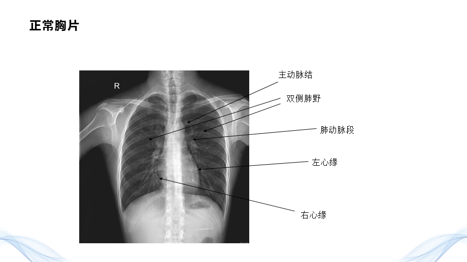 2020《影像学检查》执业医师技能培训课件.pptx_第2页