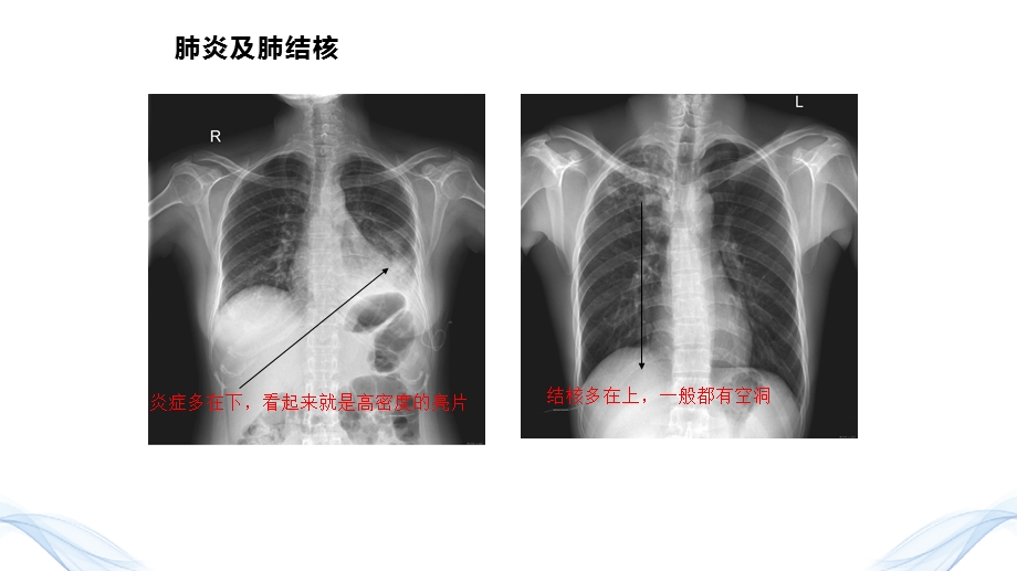 2020《影像学检查》执业医师技能培训课件.pptx_第3页