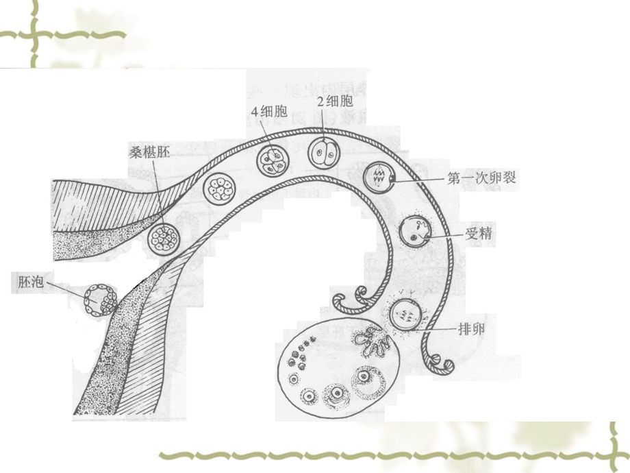 第十五章妊娠滋养细胞疾病人的护理 课件.ppt_第3页