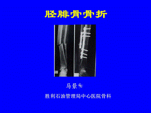 外科学多媒体ppt课件 胫腓骨骨折.ppt