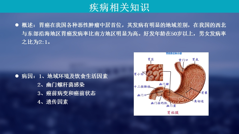 胃癌术后病人护理查房课件.pptx_第2页