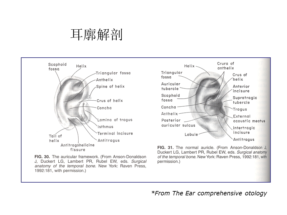 耳鼻咽喉科学中文版ppt课件 外中耳疾病.ppt_第3页