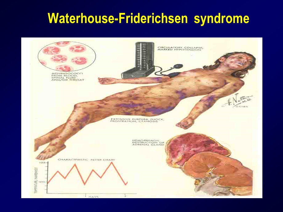 弥散性血管内凝血Disseminated Intravascular 课件.ppt_第2页