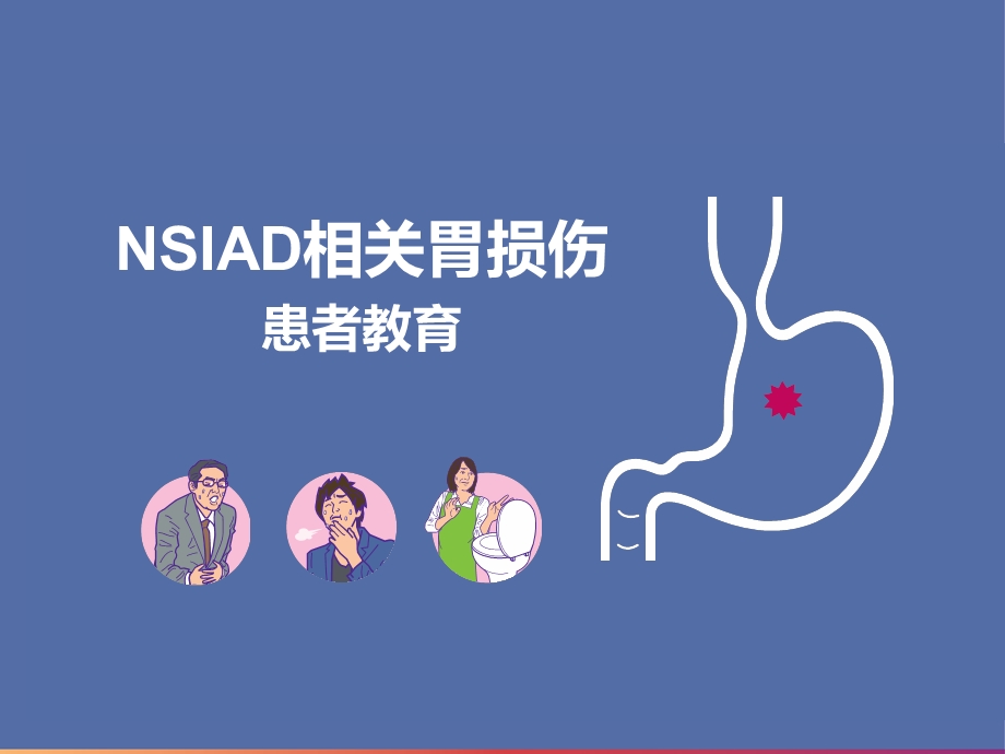 《nsaid相关胃损伤患者教育》培训ppt课件.pptx_第1页