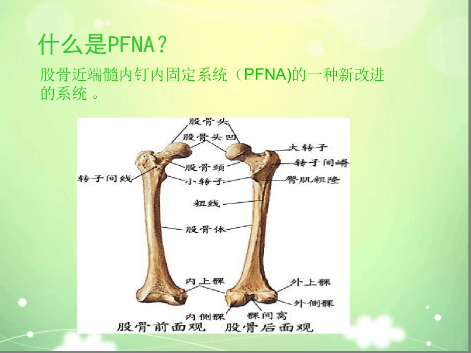 PFNA髓内钉手术配合汇总课件.ppt_第2页