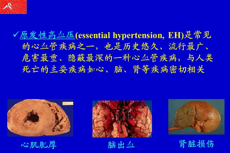 原发性高血压研究的新进展 线粒体基因突变在原发性高血压课件ppt.ppt_第2页