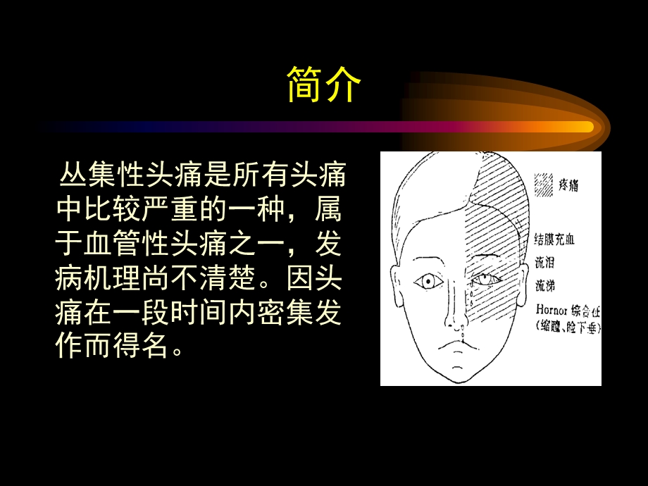 丛集性头痛-ppt课件.ppt_第2页