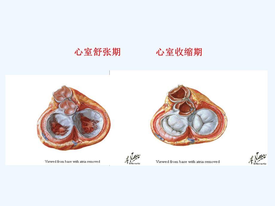 主动脉瓣置换术后的护理课件.ppt_第3页