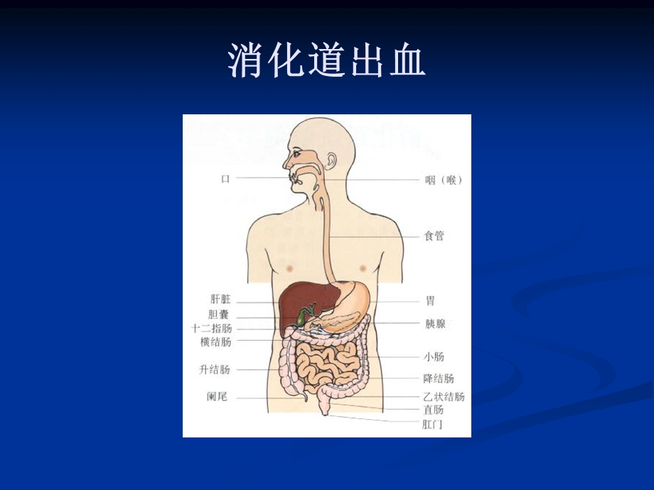 呕血与便血 课件.ppt_第2页