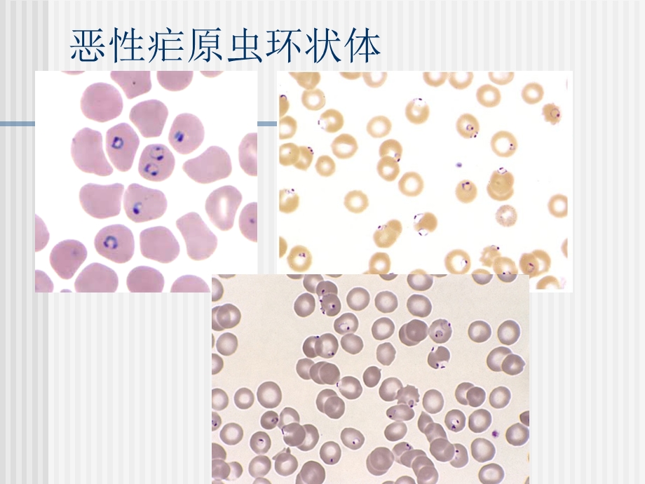 外周血涂片中的各种疟原虫课件.ppt_第2页