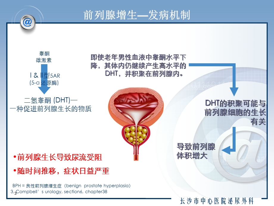 良性前列腺增生课件.ppt_第3页