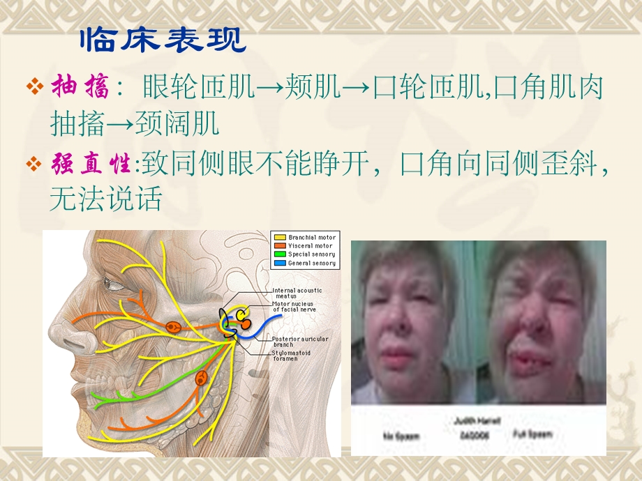 面积痉挛的围手术期护理课件.ppt_第3页