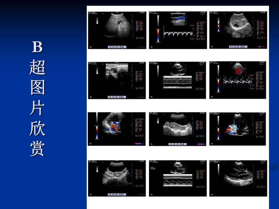 超声检查与解读报告基础知识课件.ppt_第2页