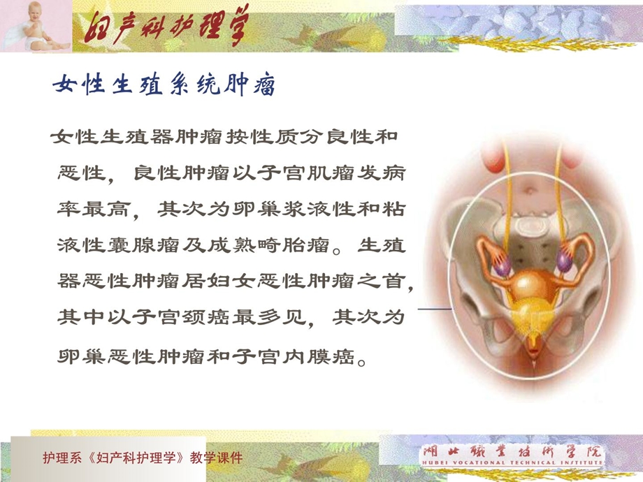 妇产科护理ppt课件女性生殖系统肿瘤精华.ppt_第2页