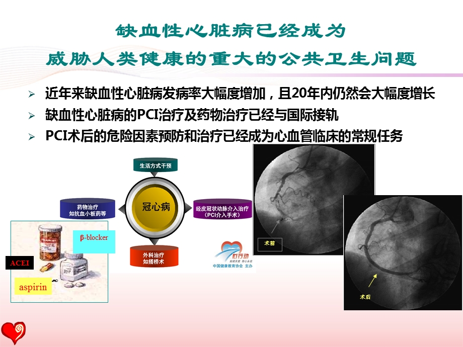 pci术后患者的心脏康复指南与现实2016盛京会 课件.ppt_第3页