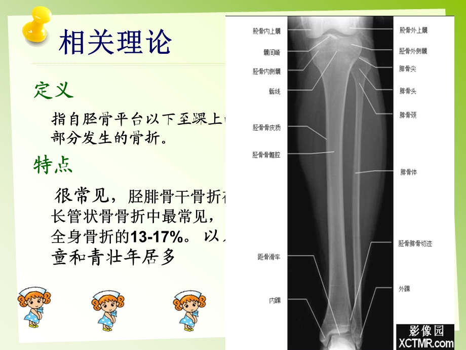 胫腓骨骨折的护理图文课件.ppt_第3页