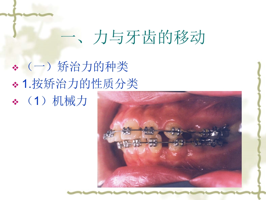 口腔正畸学 正畸治疗的生物机械原理课件.pptx_第2页