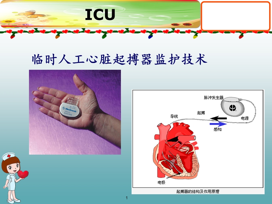 临时人工心脏起搏器监护技术课件.ppt_第1页