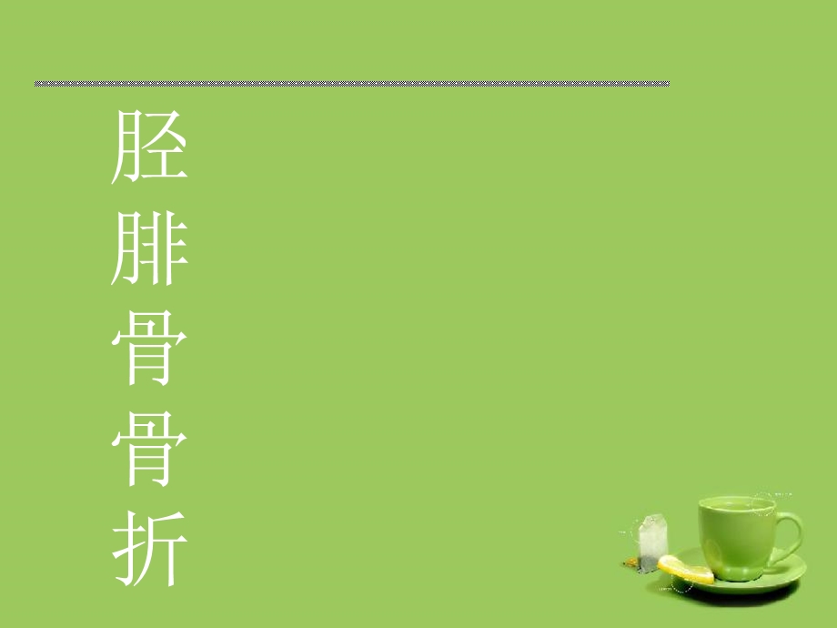 胫腓骨骨折疾病查房课件.ppt_第1页