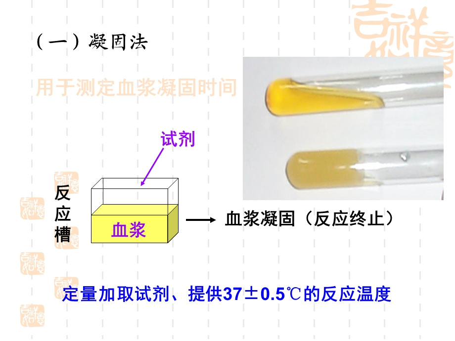 血栓弹力图 血凝仪课件.ppt_第2页