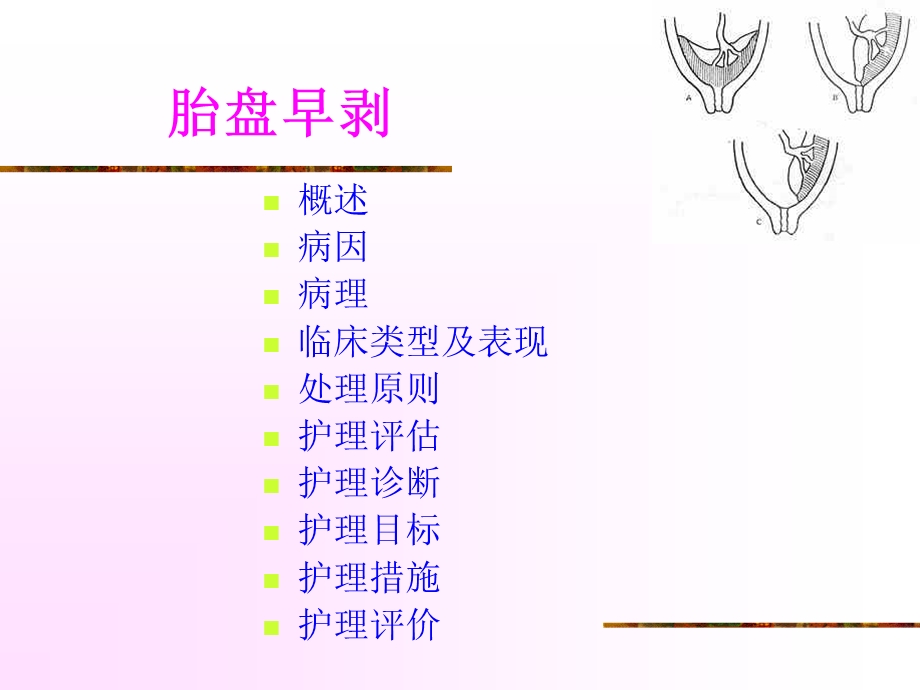 妊娠期并发症妇女的护理- 异常产褥课件.ppt_第3页