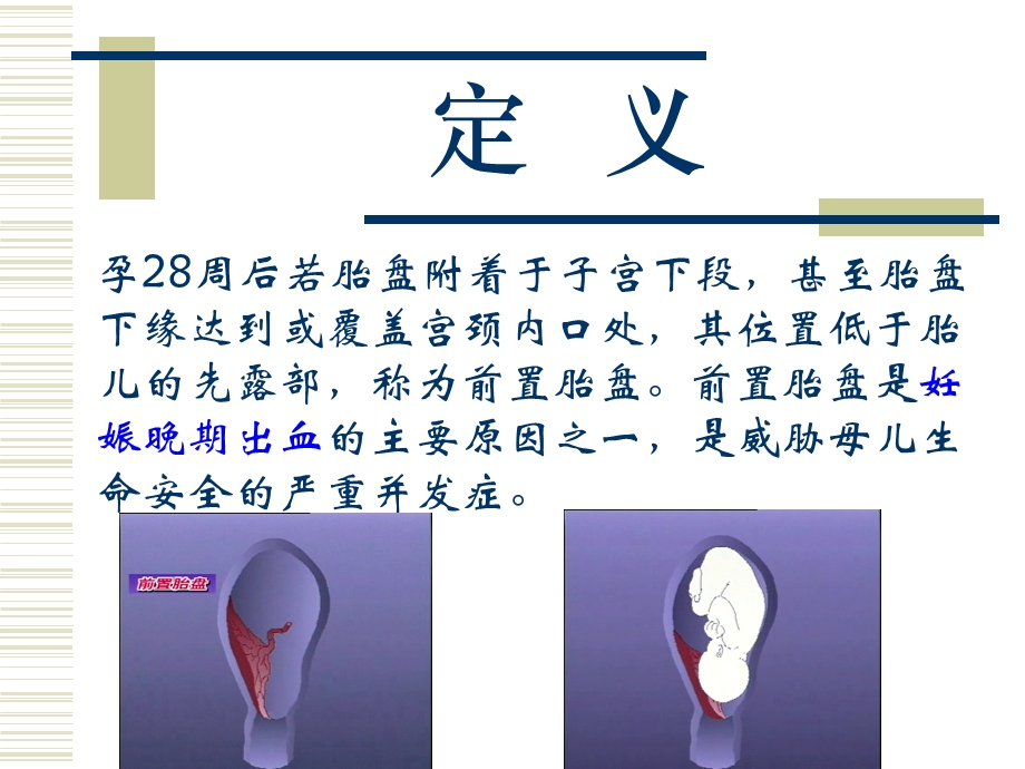 前置胎盘病人的护理课件.ppt_第3页